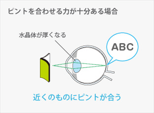 ピントを合わせる力が十分にある場合：水晶体が厚くなる。近くのものにピントが合う